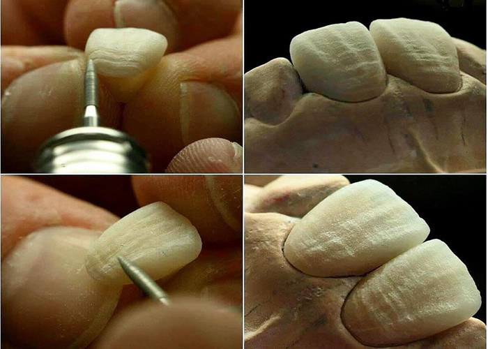 Puente de corona de cerámica con excelente biocompatibilidad para la restauración dental