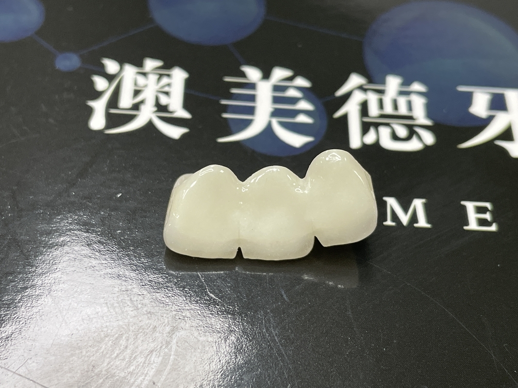Coronas de cerámica translúcidas para la restauración dental con limpieza fácil y resultados duraderos
