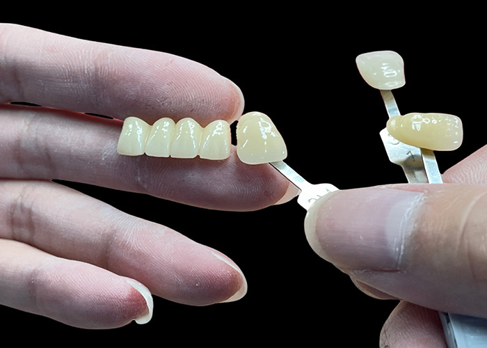 Resistente a las manchas Puente de porcelana confortable adecuado para la restauración dental