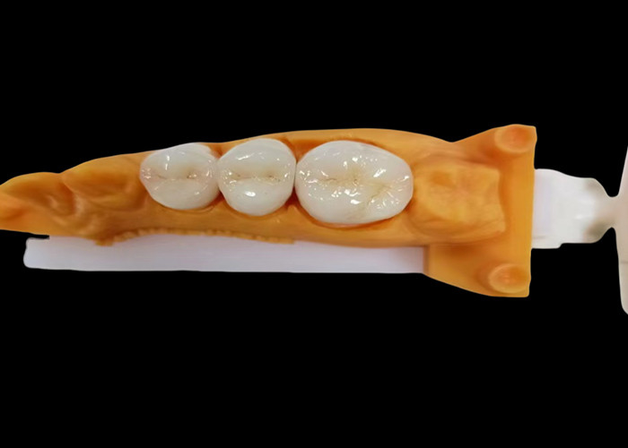 Corona dental de zircónia resistente al desgaste con resistencia a las astillas y manchas y estética natural de laboratorio dental de China