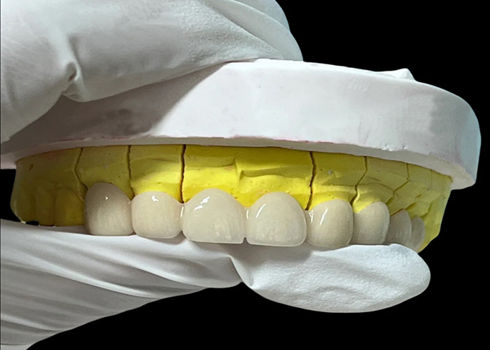 Corona dental de porcelana de zirconia con acabado estético y de aspecto natural de laboratorio dental de China
