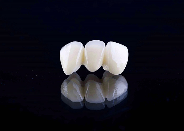 Corona dental de porcelana de zirconia con acabado estético y de aspecto natural de laboratorio dental de China