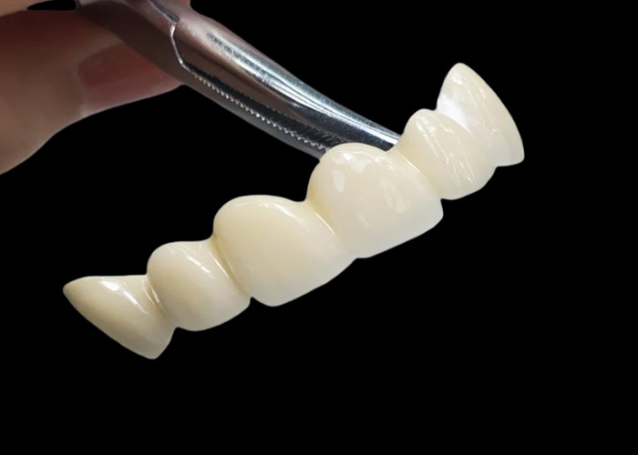 Corona dental de zircónia translúcida con alta durabilidad resistente a las manchas de laboratorio dental de China