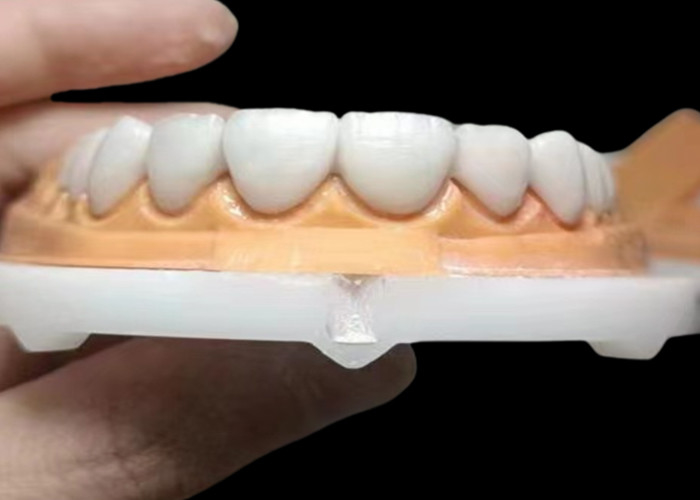 Corona dental de zircónia translúcida con alta durabilidad resistente a las manchas de laboratorio dental de China