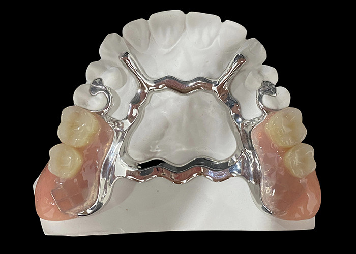 Dentadura removible parcial de base metálica y resina acrílica para un ajuste seguro y una apariencia natural