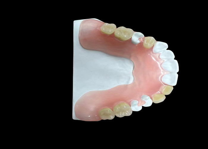 Dentadura completa de acrílico ligera duradera asequible y personalizable Solución para el reemplazo completo de dientes