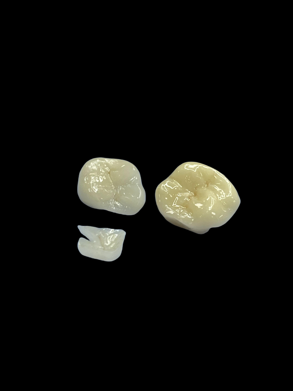 Enlaces de porcelana hipoalergénicos Enlaces para la reparación de dientes Color natural y fácil mantenimiento