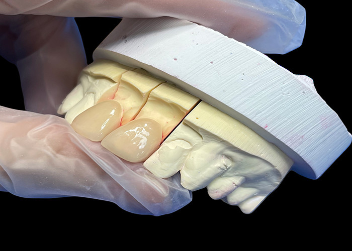 Precisión de resistencia EMAX incisora de chapa de porcelana para restauraciones estéticas de aspecto natural
