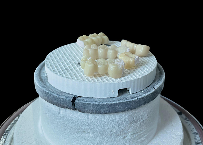 Puente dental de porcelana cómodo con construcción totalmente cerámica para una resistencia excepcional al desgaste
