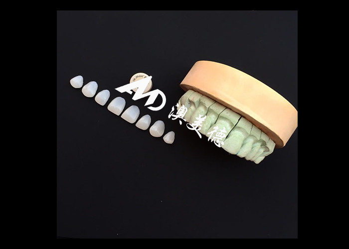 Transforma tu sonrisa con IPS emax Prensa carillas de porcelana Fortaleza Estética y durabilidad combinadas