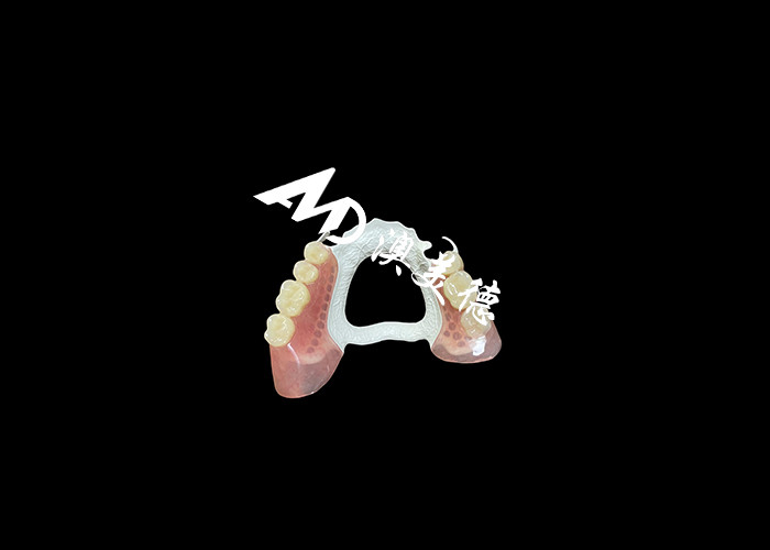 Dentadura extraíble de alta calidad con marco HPP duradero y base acrílica cómoda para un ajuste seguro y un rendimiento duradero
