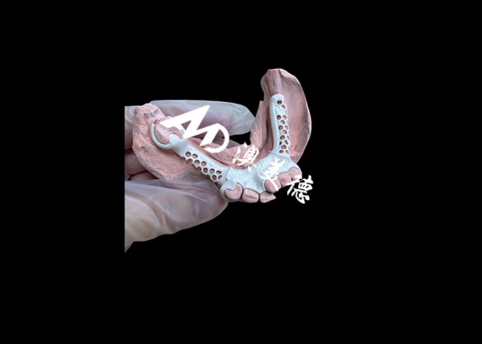 Dentadura extraíble con marco HPP y base acrílica para una mayor durabilidad y comodidad