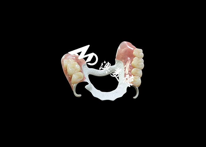 Dentadura extraíble con marco HPP y base acrílica para una mayor durabilidad y comodidad