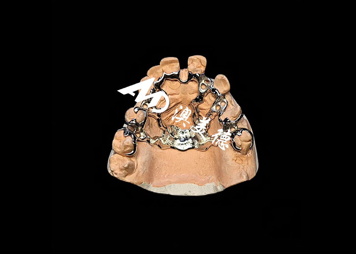 Dentadura extraíble con marco de metal fundido para una resistencia y estabilidad superiores con una comodidad duradera