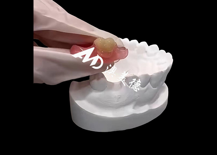 Las prótesis flexibles Nesbite ofrecen una solución perfecta para una sonrisa cómoda y de aspecto natural