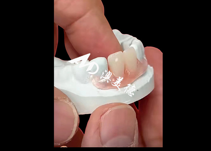 Las prótesis flexibles Nesbite ofrecen una solución perfecta para una sonrisa cómoda y de aspecto natural