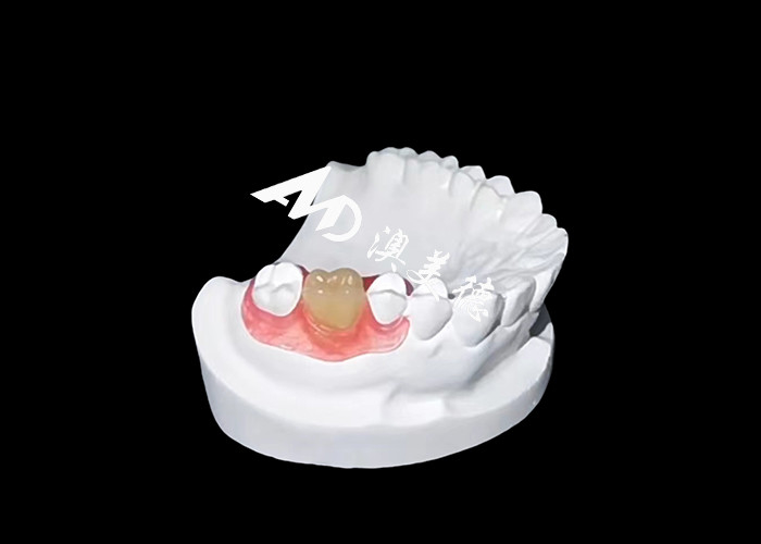 Las prótesis flexibles Nesbite ofrecen una solución perfecta para una sonrisa cómoda y de aspecto natural