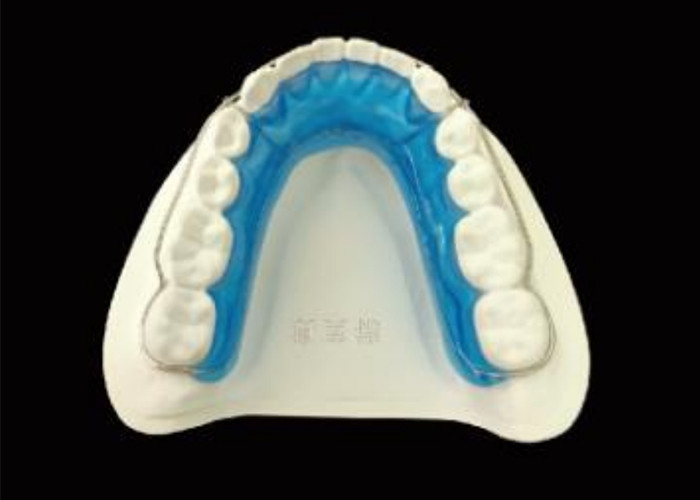 Mantenga su sonrisa con el retenedor de Begg para una alineación perfecta y resultados duraderos