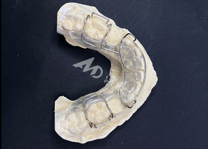 Aparatos de ortodoncia para la corrección de la alineación de los dientes