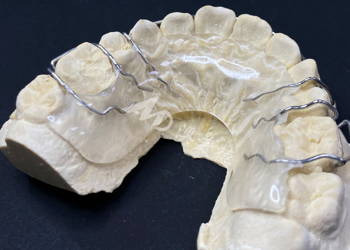 Aparatos de ortodoncia para la corrección de la alineación de los dientes