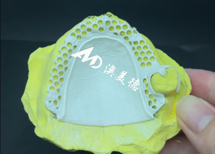 Cuadro de dentaduras removibles HPP Adaptación personalizada para una función óptima, confort y estética