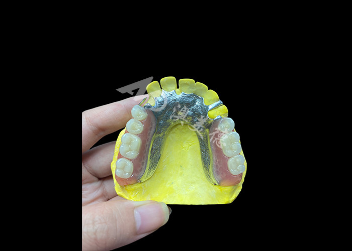 Dentes parciales de fundición ajustables para mayor comodidad y estabilidad, perfectos para masticar y hablar