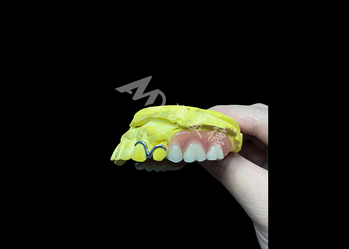 Dentes parciales de fundición ajustables para mayor comodidad y estabilidad, perfectos para masticar y hablar