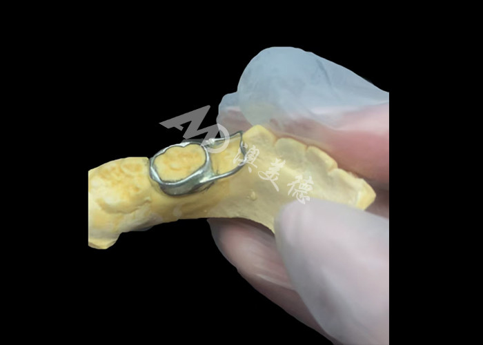 Mantener el espacio ortodóntico un dispositivo invaluable que ingeniosamente protege las lagunas dentales de los niños asegurando el desarrollo adecuado de los dientes.