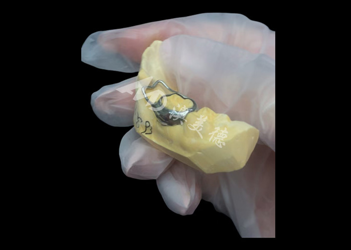 Mantener el espacio ortodóntico un dispositivo invaluable que ingeniosamente protege las lagunas dentales de los niños asegurando el desarrollo adecuado de los dientes.