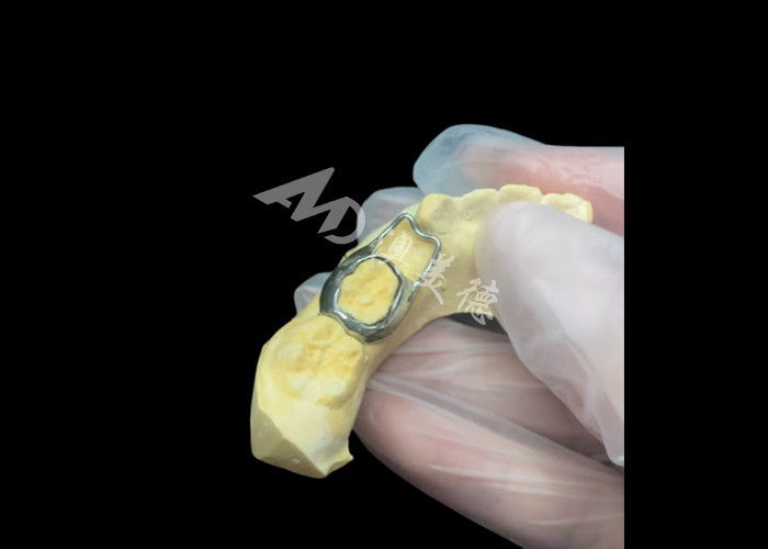 Mantener el espacio ortodóntico un dispositivo invaluable que ingeniosamente protege las lagunas dentales de los niños asegurando el desarrollo adecuado de los dientes.