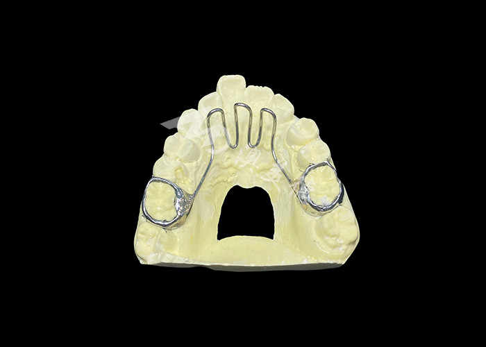 Las cunas de la lengua Aplicación de ortodoncia utilizada para abordar problemas de empuje de la lengua y ayuda en la alineación dental adecuada