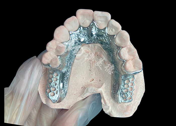 Cuadro dentario de prótesis dentaria sin dientes diseñado para la estabilidad y la función