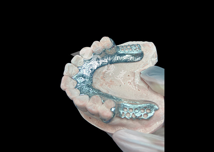Cuadro dentario de prótesis dentaria sin dientes diseñado para la estabilidad y la función