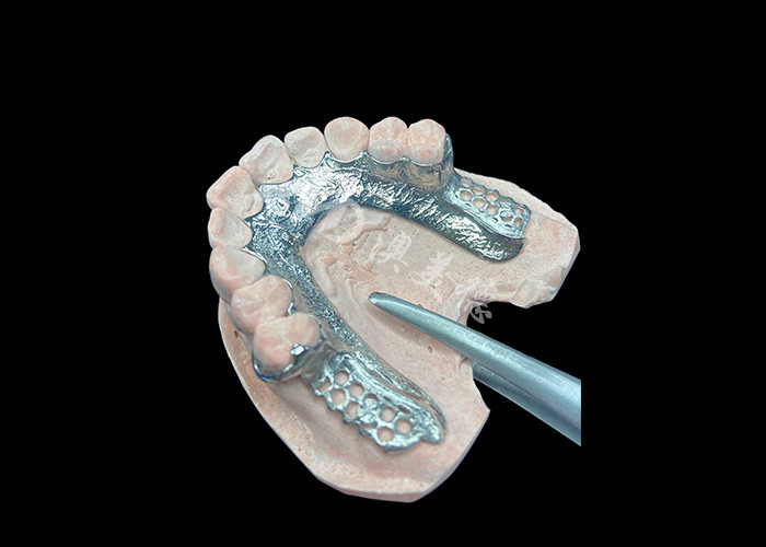 Cuadro dentario de prótesis dentaria sin dientes diseñado para la estabilidad y la función