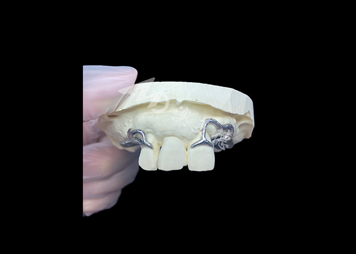 Fácil de ajustar Custom Cast Partial Denture Marco estable y de aspecto natural para resultados rápidos