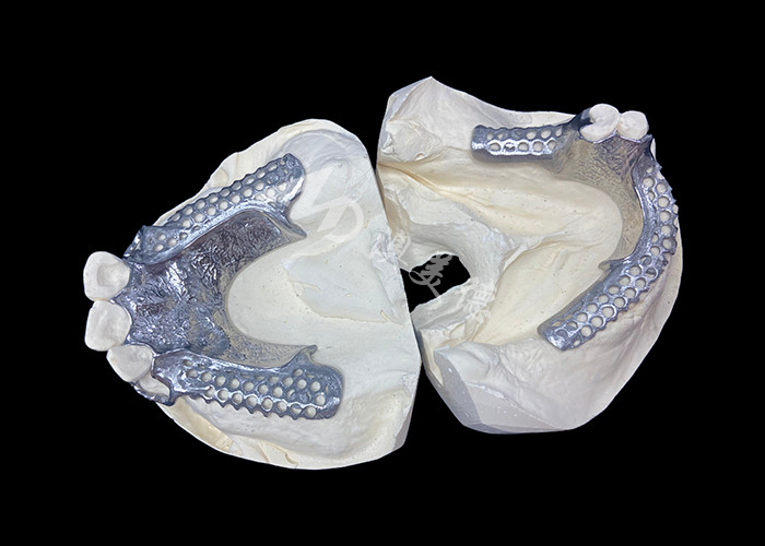 Fácil de ajustar Custom Cast Partial Denture Marco estable y de aspecto natural para resultados rápidos