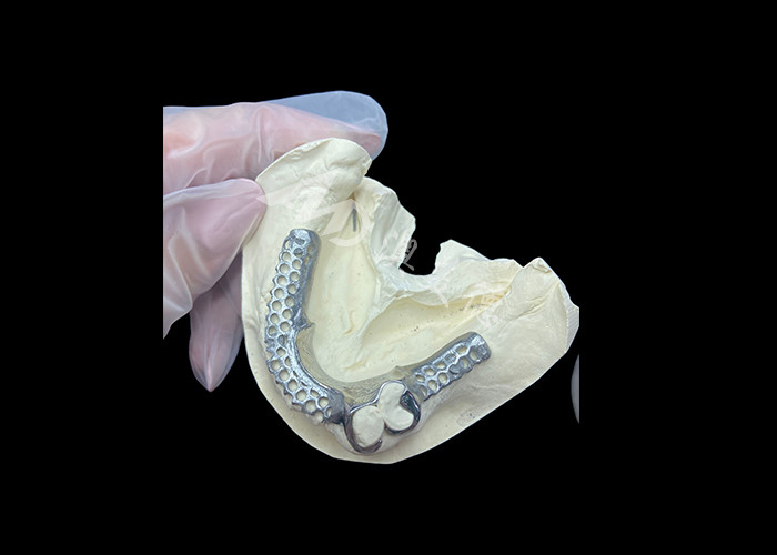 Fácil de ajustar Custom Cast Partial Denture Marco estable y de aspecto natural para resultados rápidos