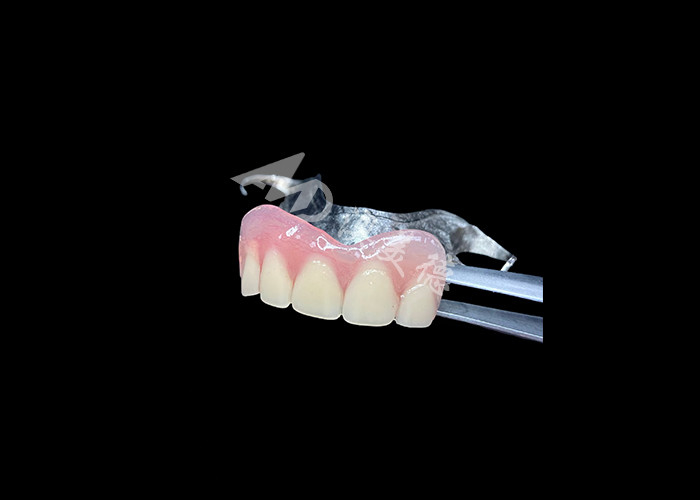 Dentaduras parciales fundidas de larga duración Mantenimiento fácil para una mejor masticación y una sonrisa perfecta