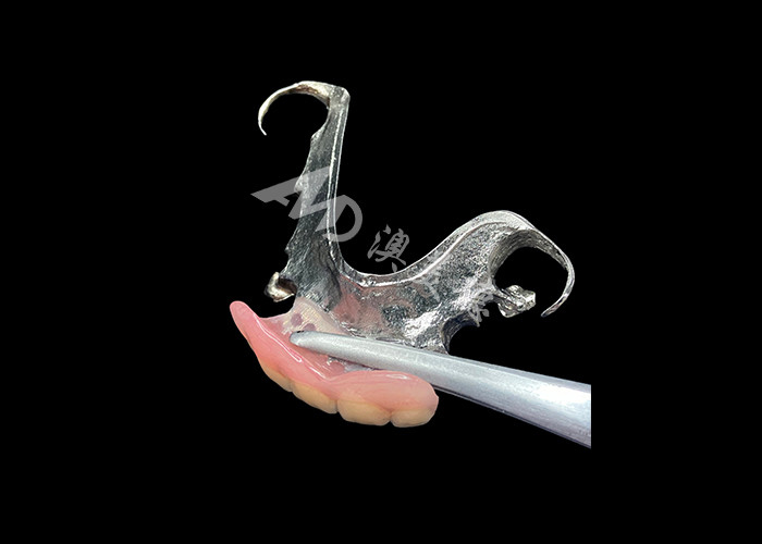 Dentaduras parciales fundidas de larga duración Mantenimiento fácil para una mejor masticación y una sonrisa perfecta