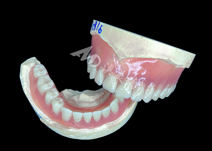 Dentaduras parciales de fundición a medida, fáciles de limpiar, ideales para restaurar la capacidad de masticar y las sonrisas