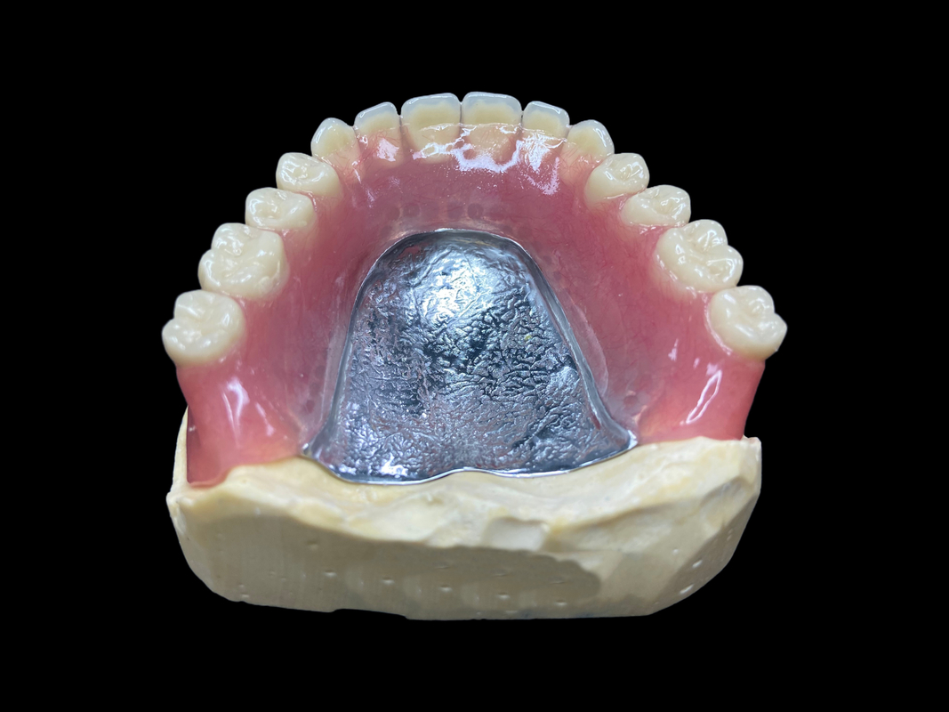 Dentaduras parciales de fundición a medida, fáciles de limpiar, ideales para restaurar la capacidad de masticar y las sonrisas