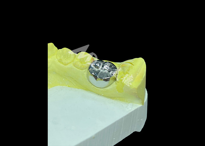 Función duradera Corona fundida de metal durable para restauración dental superior