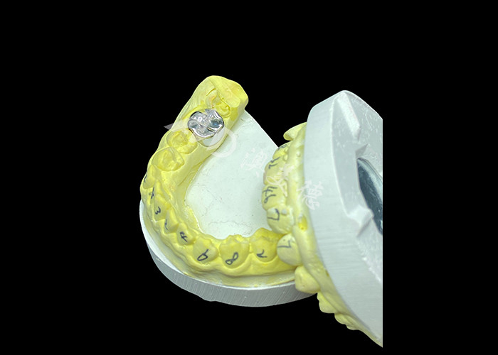 Función duradera Corona fundida de metal durable para restauración dental superior