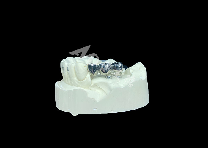 Implantes dentales de corona de titanio de pleno molde de larga duración para reemplazo de dientes perdidos