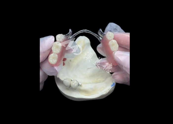 Porcelana duradera fundida a la corona dental de metal PFM corona para la restauración
