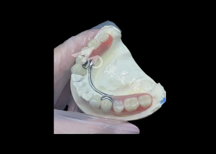 Porcelana duradera fundida a la corona dental de metal PFM corona para la restauración