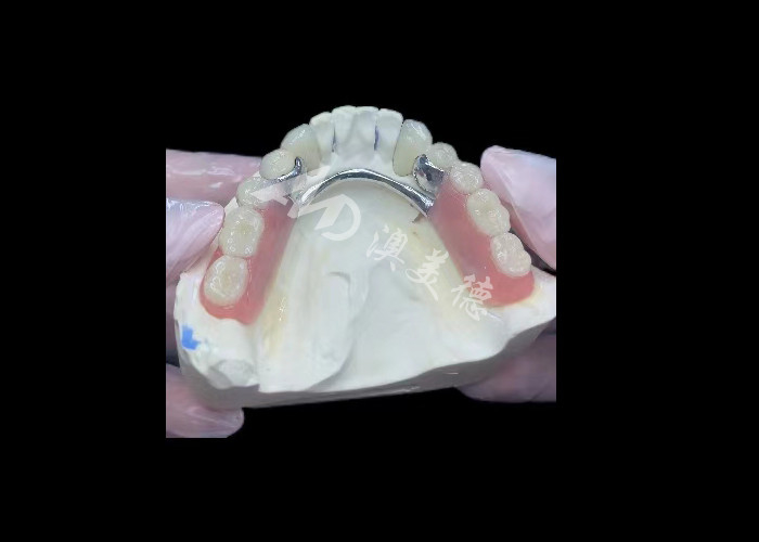 Porcelana duradera fundida a la corona dental de metal PFM corona para la restauración