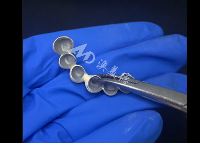 Porcelana biocompatible fusionada con corona de metal de alta durabilidad para una mejor restauración
