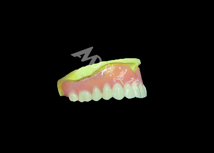 Dentaduras parciales fundidas diseñadas para la durabilidad, la comodidad y la estética y duran más tiempo