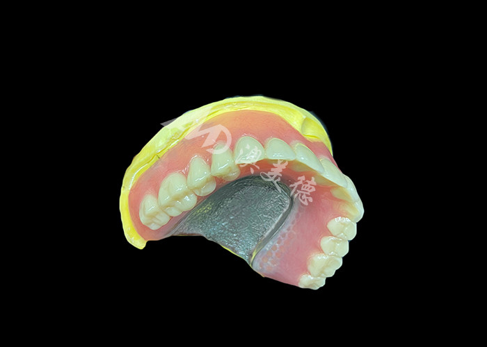 Dentaduras parciales fundidas diseñadas para la durabilidad, la comodidad y la estética y duran más tiempo
